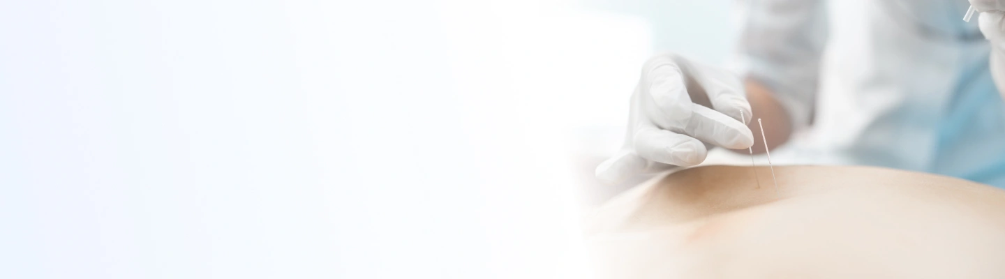 Acupuncture Treatment