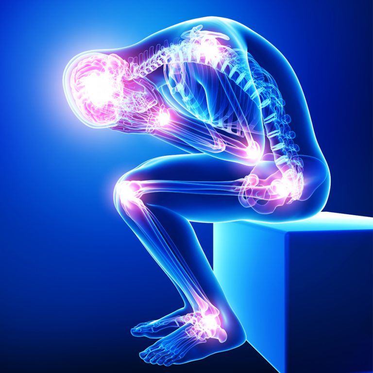 CHRONIC PAIN