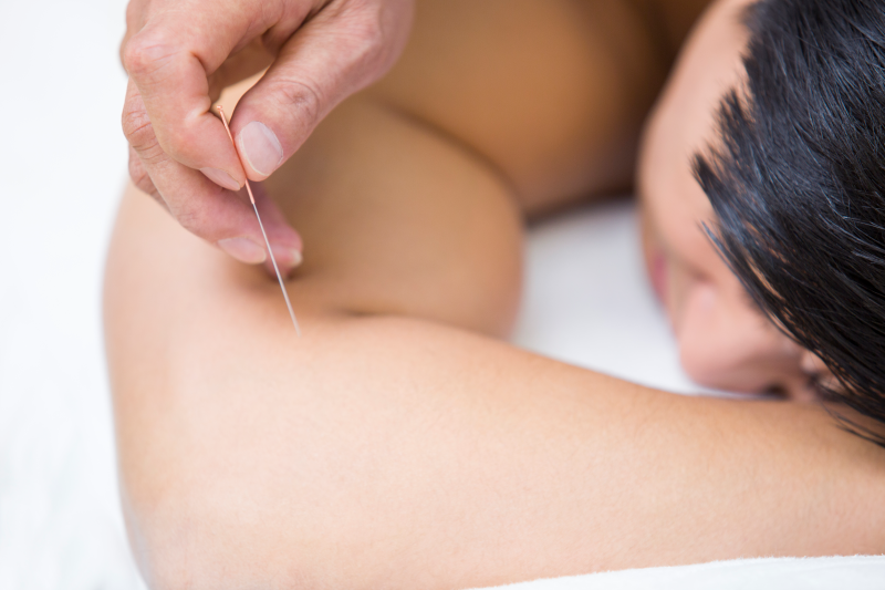 http://Acupuncture%20Boosts%20Immune%20System