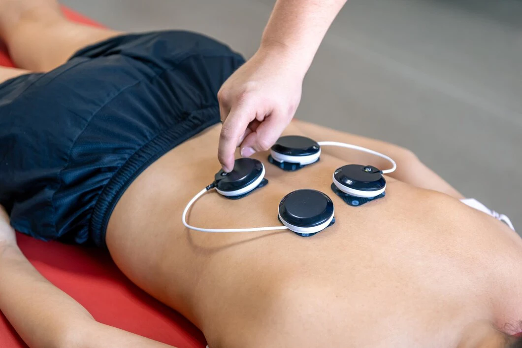 Transcutaneous Electrical Nerve Stimulation