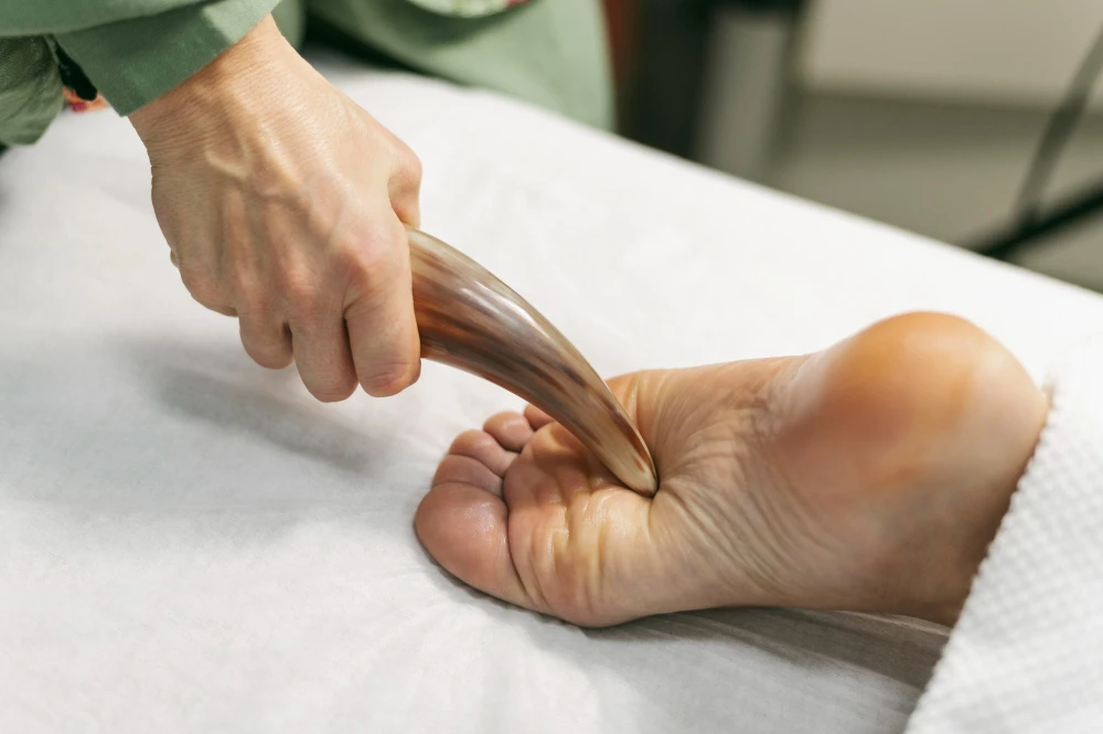 plantar fasciitis
