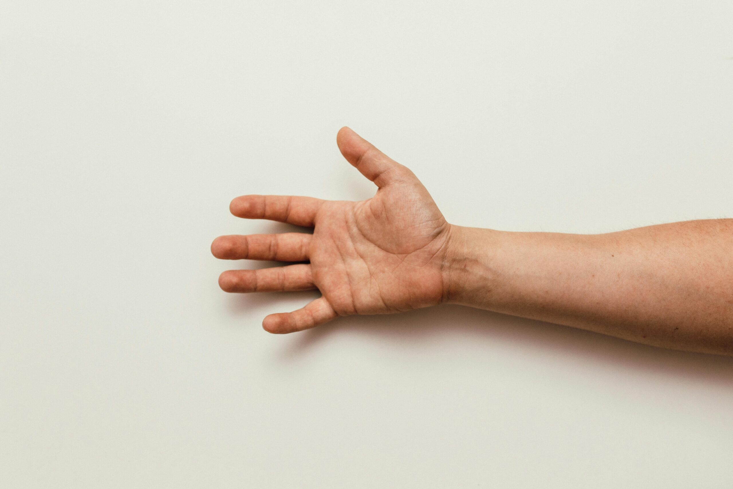 Carpal Tunnel Symptoms: A Comprehensive Guide to Early Signs & Stages